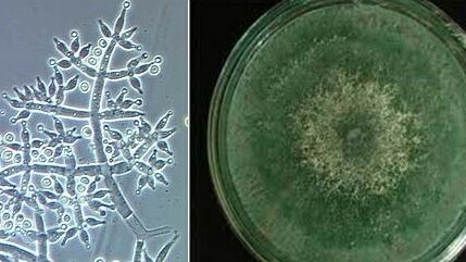 Trichoderma-2.jpg